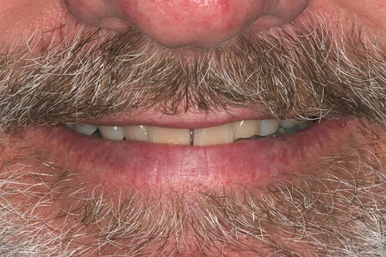 Before dental treatment - Case 6