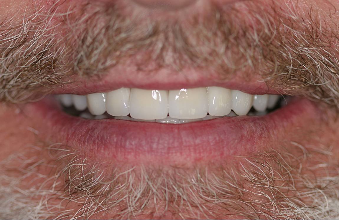 After dental treatment - Case 6